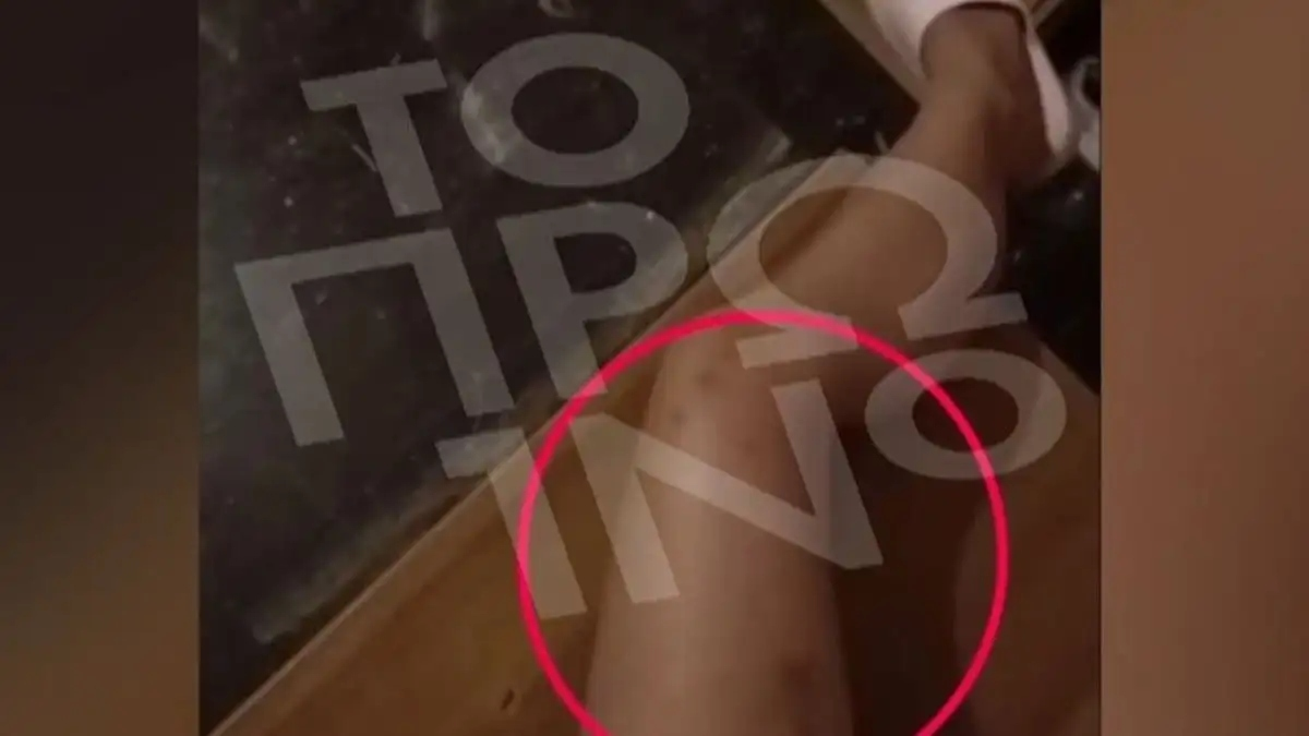 19χρονη καταγγέλλει τον 25χρονο πρώην σύντροφό της για ξυλοδαρμό – «Γιατί με χτύπησες, πονάω»